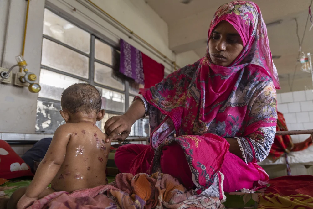 Bangladesh suspected measles outbreak 2026