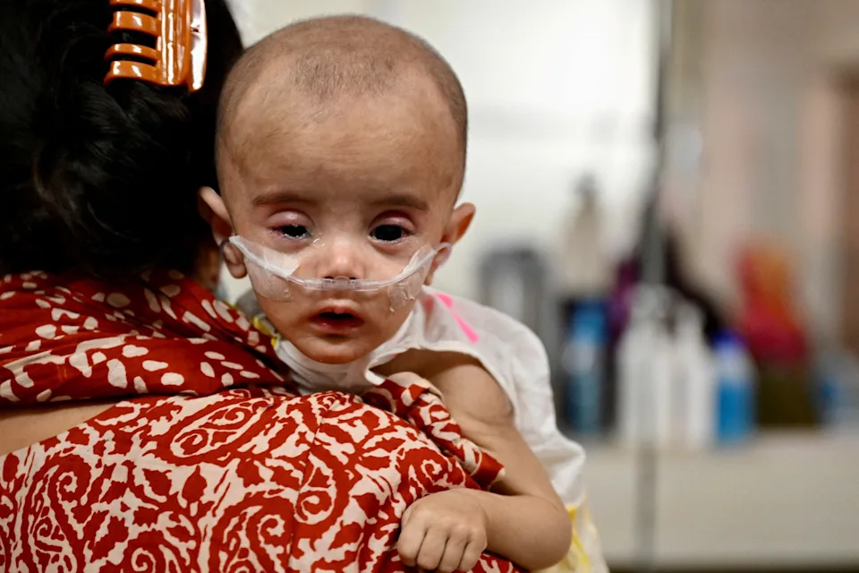 Measles death toll surges in Bangladesh as outbreak overwhelms hospitals