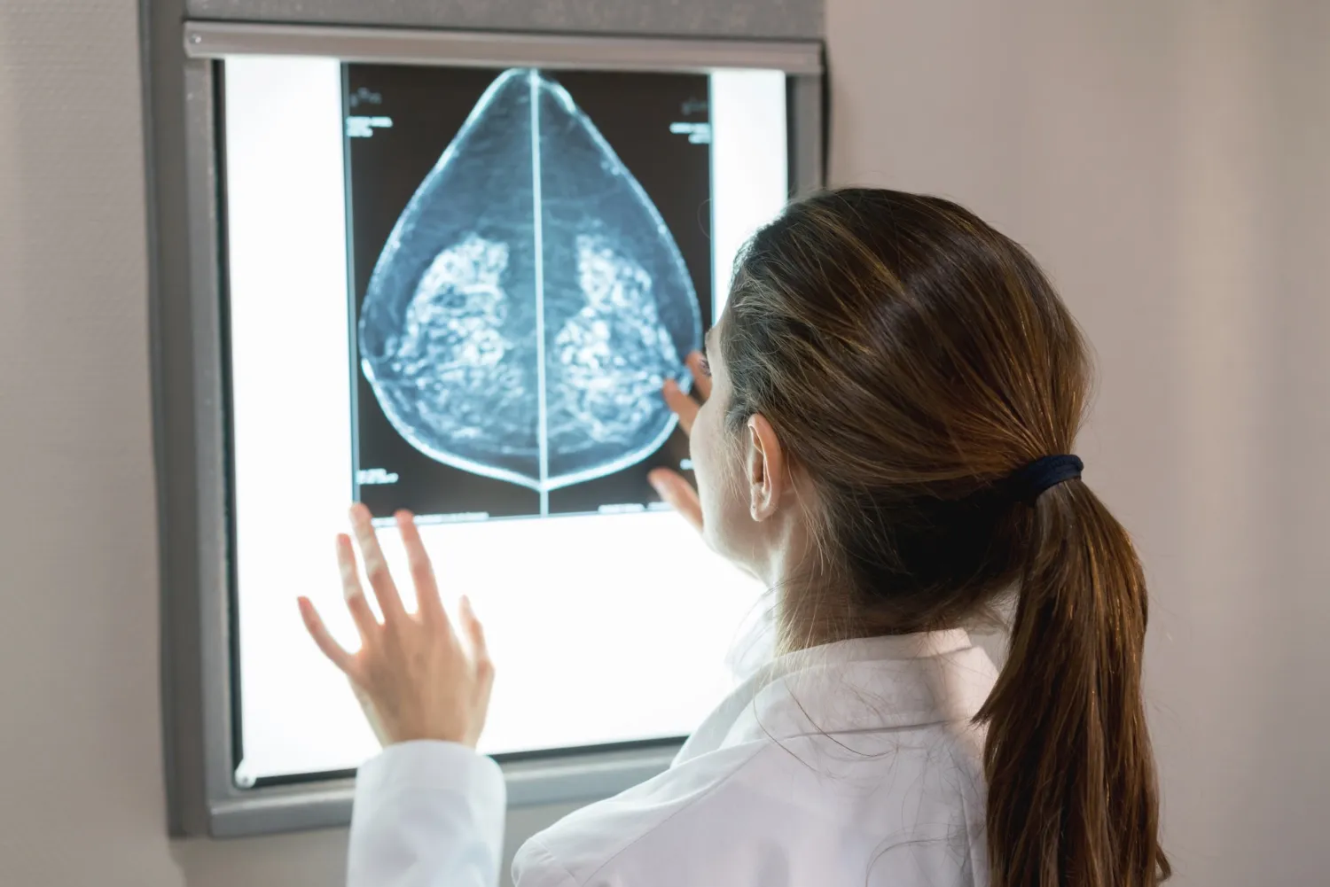 low-dose endoxifen breast density Research illustration