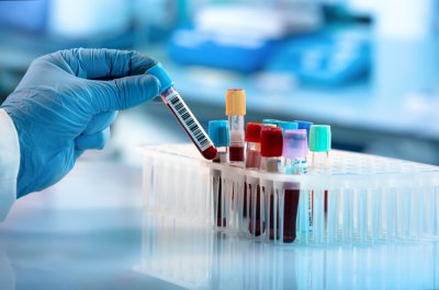 Eye Foundation Hospital medical lab technician job conducting diagnostic tests in a hospital laboratory