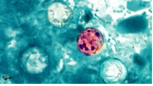 First Deaths in Cyclosporiasis Outbreak