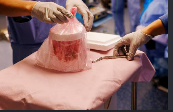 Tim Andrews with doctors after pig kidney transplant