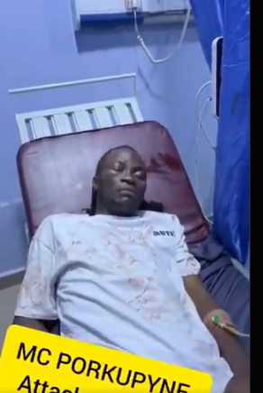 MC Edopikin reacts to Porkupyne attack