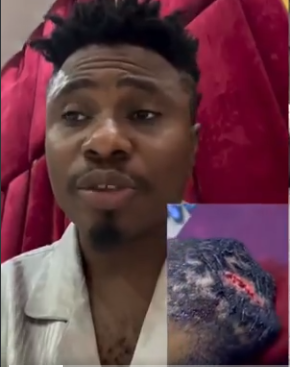 MC Edopikin reacts to Porkupyne attack